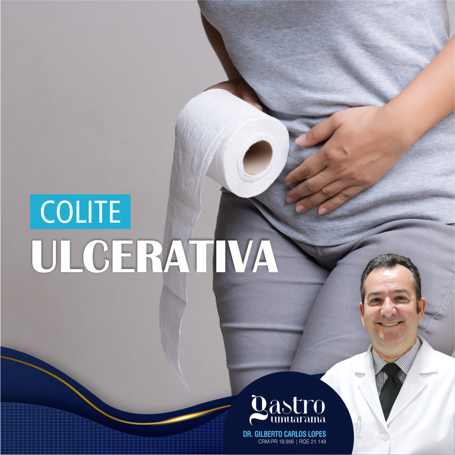 Diagnóstico da Colite Ulcerativa