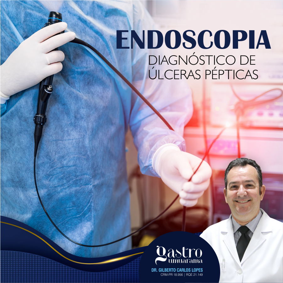 Úlcera Péptica | Endocospia