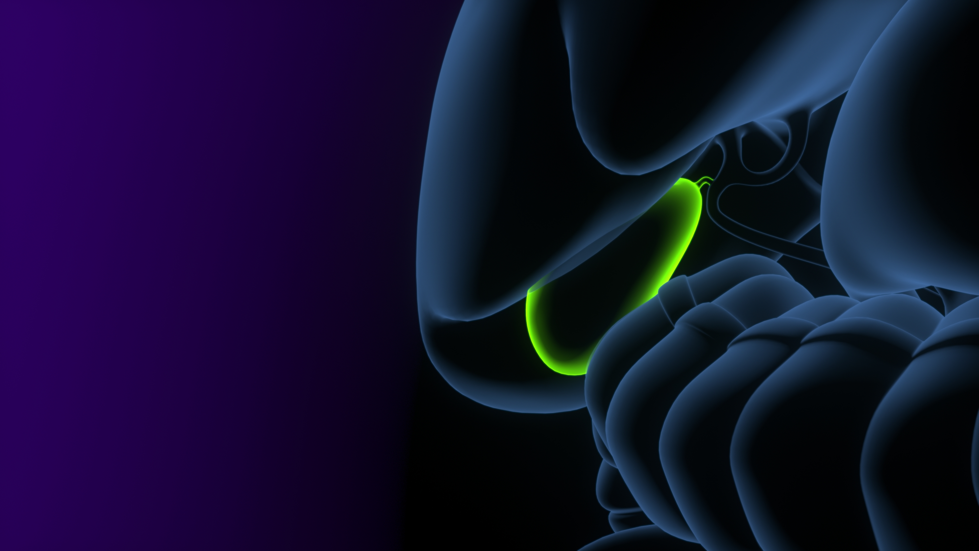 Cálculos Biliares | Endoscopia