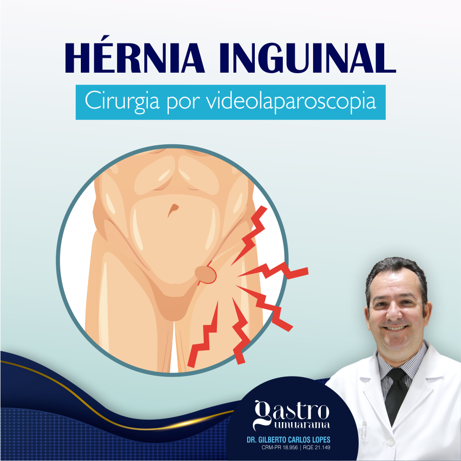 Hérnia Inguinal | Videolaparoscopia