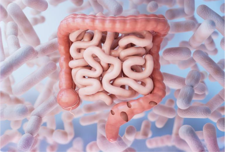 Pólipos Gastrointestinais 