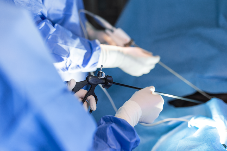 Cirurgia por Videolaparoscopia