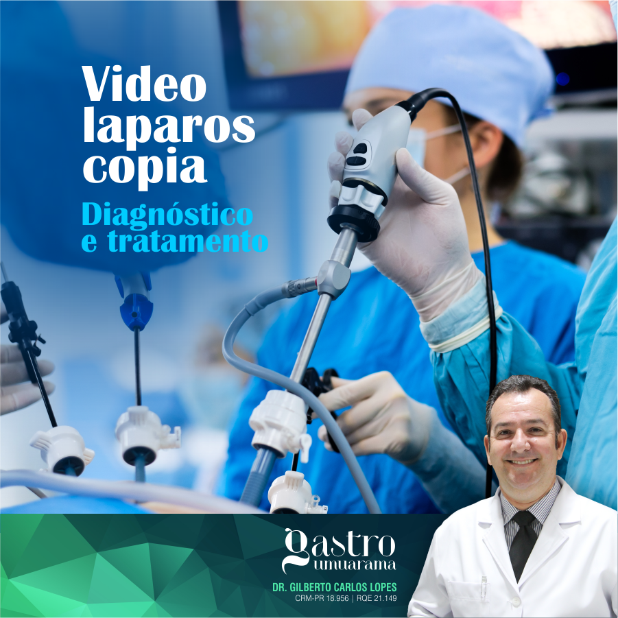 Videolaparoscopia | Diagnóstico e Tratamento