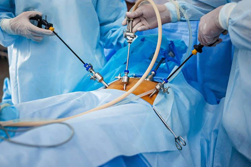 Conheça a Técnica Cirúrgica com Menos Cortes e Recuperação Mais Rápida